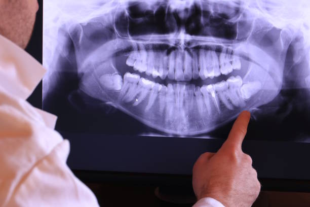 Best Tooth Infection Emergency Dentist  in Columbus Grove, OH