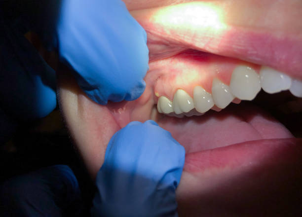 Best Teeth Whitening  in Columbus Grove, OH