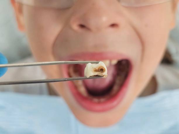 Best Root Canal Emergency Dentist  in Columbus Grove, OH
