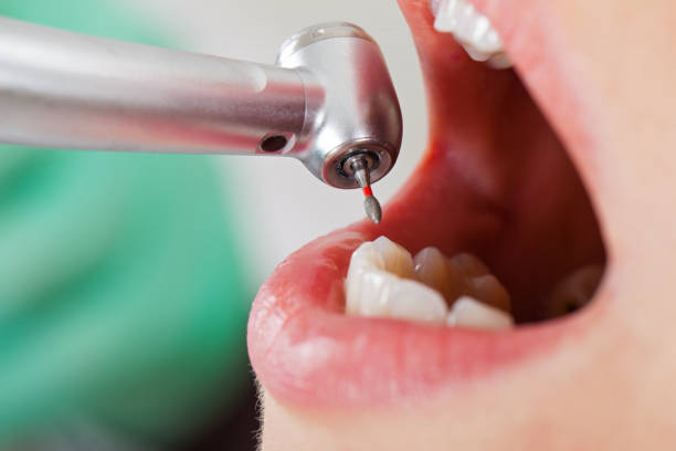 Best Root Canal Emergency Dentist  in Columbus Grove, OH